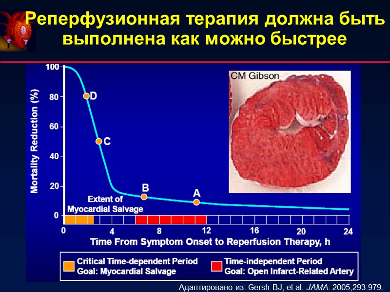 Реперфузионная терапия должна быть выполнена как можно быстрее Адаптировано из: Gersh BJ, et al.